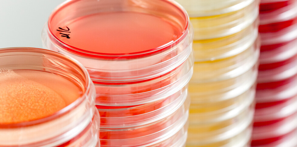 petri dishes, blood culture
